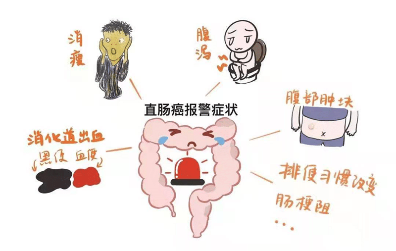 【州醫科普】劉明澤：大腸癌的預防與治療