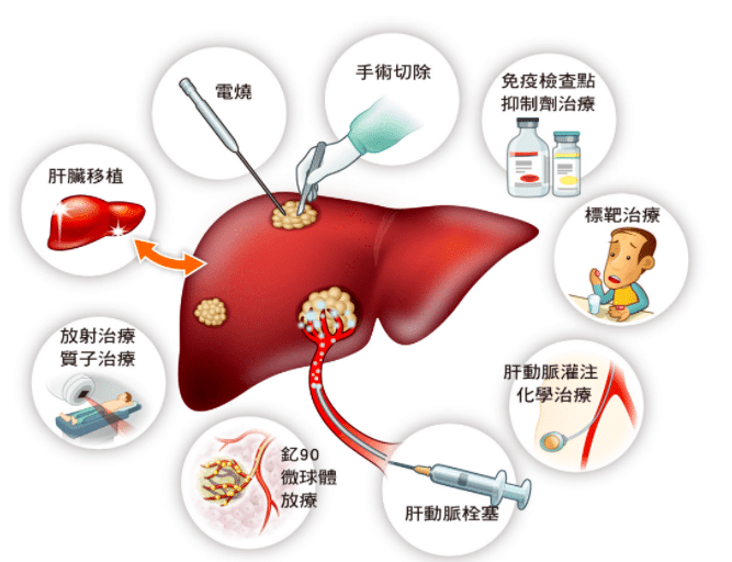 【州醫(yī)科普】張廣蕾：預(yù)防肝癌，從現(xiàn)在做起