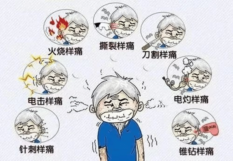 【州醫(yī)科普】和神經(jīng)外科醫(yī)師聊一哈“天下第一痛”