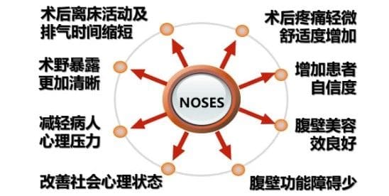 胃腸腹壁疝外科成功實施腹壁無輔助切口的腹腔鏡直腸癌根治術